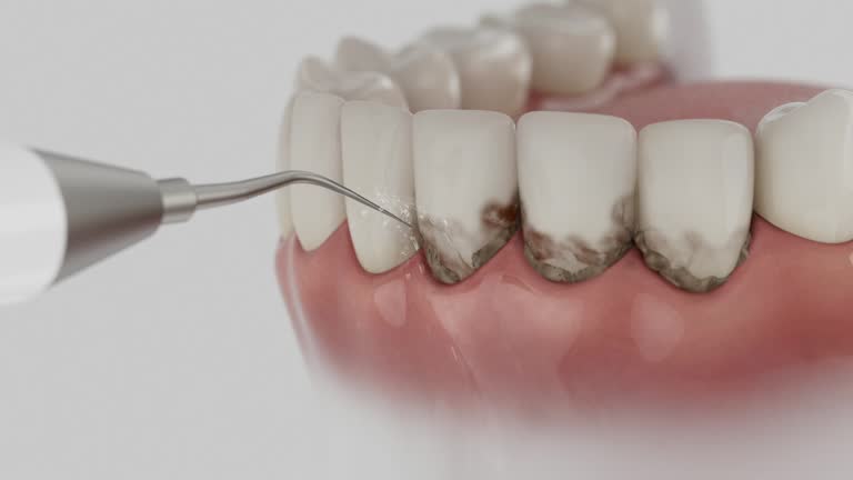 Reliable Dental Implants contractor in Leoti, KS by Smile Center Dentistry